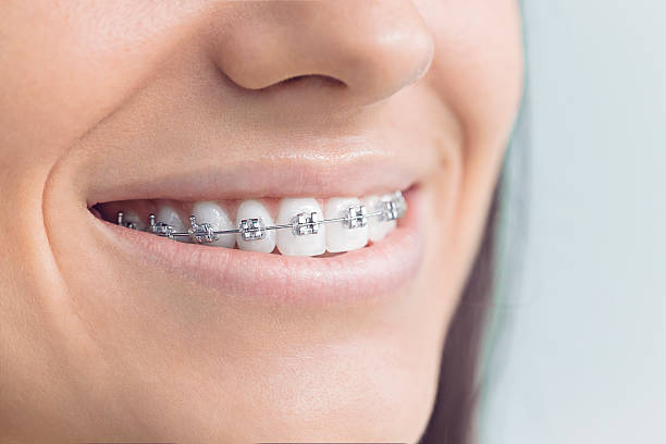 Best Veneers and Lumineers  in Blanchester, OH
